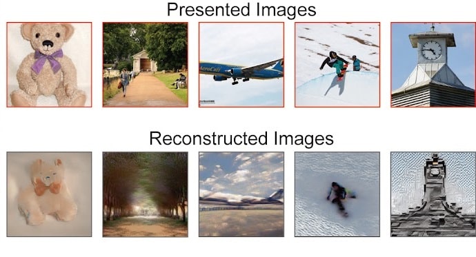 ia brain images 