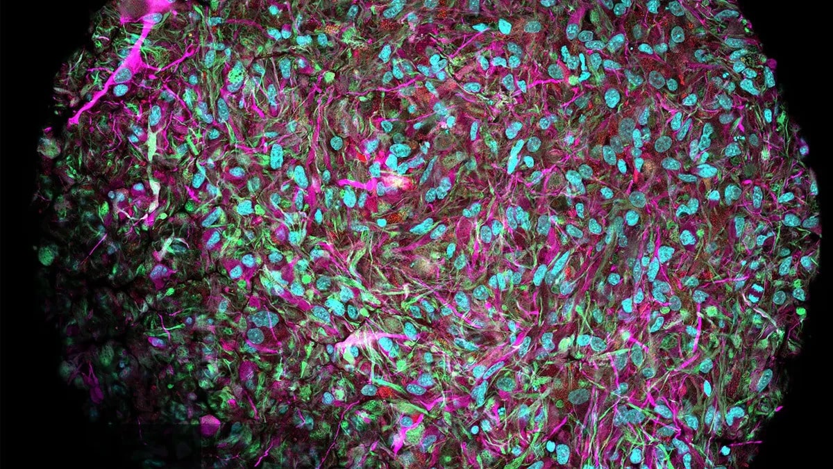 organoid brain john hopkins 