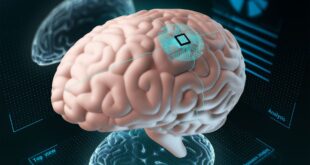 WIMAGINE Interface cerveau-ordinateur Paraplégie Technologie médicale CES 2024